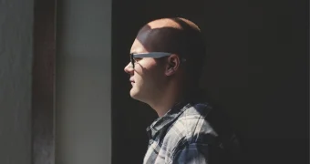 Подростки в России начали массово лысеть