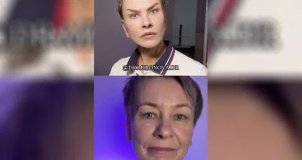 60-летняя россиянка сделала пластику, чтобы стать похожей на Shaman: «Я патриотка»
