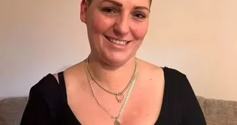 Больная раком женщина рассказала о первом признаке смертельной болезни: присмотритесь к ногтям