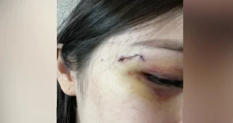 Гинеколог из Алматы поделилась жуткой историей нападения пациентки