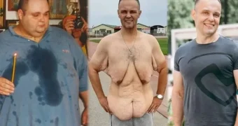 Взял себя в руки и сбросил два центнера: весивший 270 килограммов россиянин привёл себя в форму