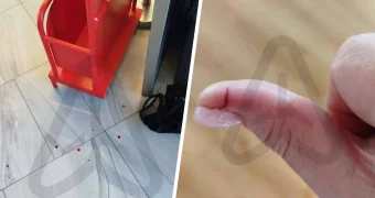 Россиянка порезала палец сотруднице авиакомпании из-за нежелания оплачивать багаж