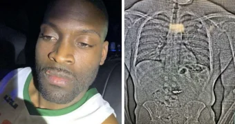 Вор проглотил бриллиантовые серьги стоимостью 769 тысяч долларов