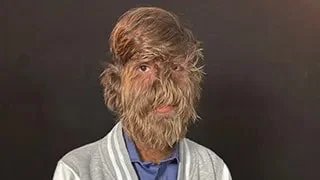 Самое волосатое лицо в мире: новый рекорд Гиннесса