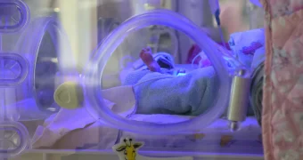 Скандал в роддоме: врачи разбираются в причинах ожогов на теле новорожденного в Казахстане