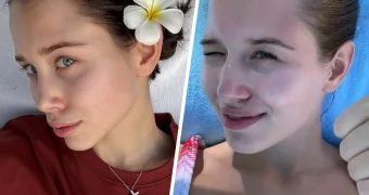19-летняя невеста Григория Лепса показала фото до пластики