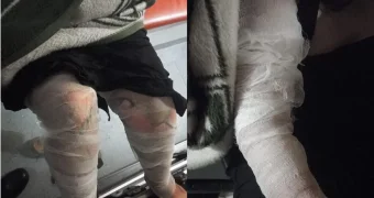 Казахстанцы получили ожоги в загоревшемся на ходу такси — один из пассажиров в реанимации