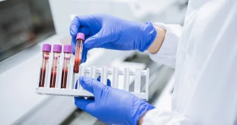 Прорыв в медицине: создан анализ крови для выявления тысяч генетических заболеваний