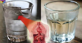 Врач рассказала, помогает ли холодная вода похудеть