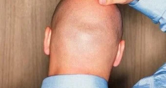 Армянский банк поинтересовался у клиента, почему тот лысый