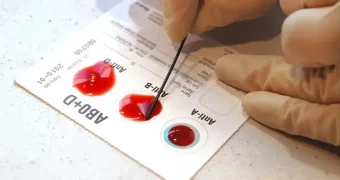 Ученые нашли женщину с уникальной группой крови: почему для нее это не дар божий, а проклятье