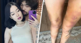 Жена известного рэпера из Казахстана обвинила его в жестоком избиении