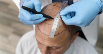 Мужчина забросил дымовую шашку в клинику по пересадке волос, когда узнал цены