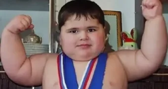 Похудение стало фатальным: история жизни и смерти самого крупного ребёнка в мире