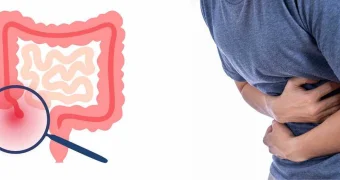 В Мангистау отмечается рост острых кишечных инфекций