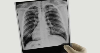 Туберкулез у сотрудников сферы водоснабжения и педагогов выявляли в Мангистау: медики обратились к работодателям