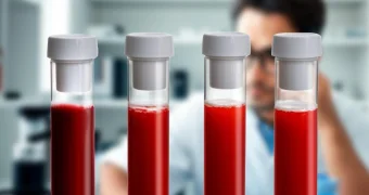 Какая группа крови является самым главным признаком дворянского происхождения