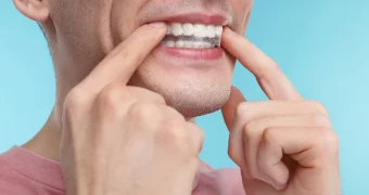 Стоматолог рассказал о последствиях самостоятельной установки пломб с маркетплейсов