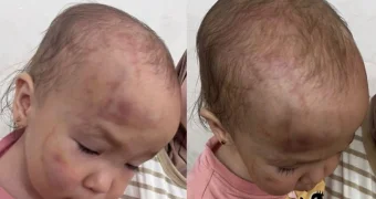 В Актау ребенка избили в частном детском саду