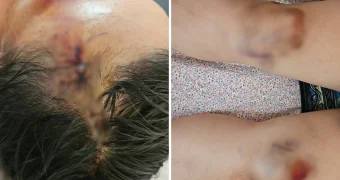 Женщину с детьми сбили на «зебре» в Актау - пострадавшая отказалась от госпитализации из-за сыновей