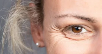 Какой продукт вызывает ранние морщины: диетологи предупреждают