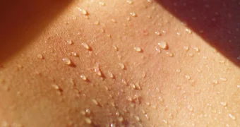 Ночная потливость может быть сигналом опасных заболеваний