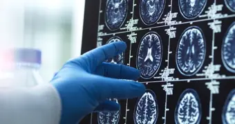 Ученые обнаружили у молодой девушки способность «путешествовать во времени»