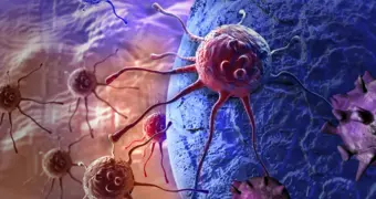 Ученые предложили лечить рак холодной плазмой