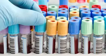 Названы анализы, точнее всего определяющие биологический возраст