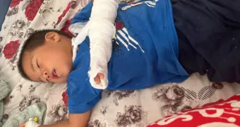 Потребовалась пересадка кожи: в Акшукуре трёхлетний ребёнок получил травму в частном детском саду