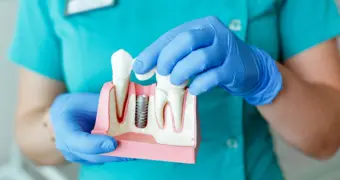 Казахстанец потратил на импланты более 32 миллионов тенге и "установил 65 зубов"