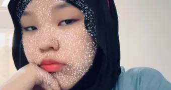 Семья из Актау просит помощи в лечении 15-летней дочери