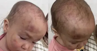 Избиение в частном садике Актау: мать обвиняет следствие в бездействии