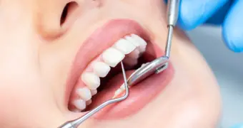 Казахстанцы нашли способ лечить зубы качественно и почти даром