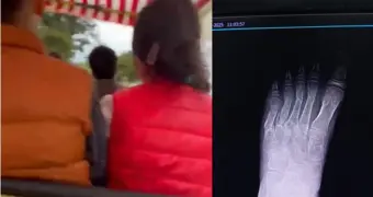 Развлечения, которые калечат в Актау: очередной несчастный случай произошел в парке «Акбота»