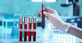 Маскируется под простуду и убивает: ученые предупредили о распространении смертельного вируса