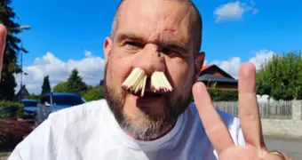 Мужчина установил рекорд по количеству засунутых в ноздри спичек