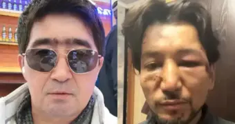 Скандал в «Нур-Мукасан»: новый участник утверждает, что солист избил его до переломов