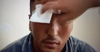 Контрактник в Казахстане лишился глаза, показывая, как надо бить стеклянные бутылки о голову