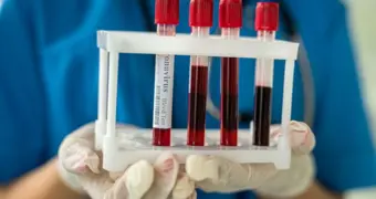 10 казахстанцев умерли от СПИДа: врачи бьют тревогу из-за отказов лечиться от ВИЧ