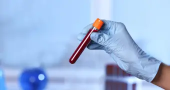 Кровь с тайной: что скрывает отрицательный резус-фактор