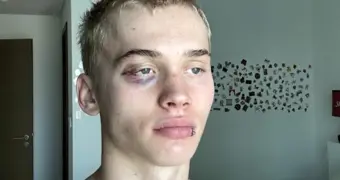 Блогер Милохин мечтает о боях с чемпионами — профи смеются