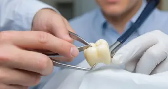 Задержана банда стоматологов, удалявших пациентам здоровые зубы