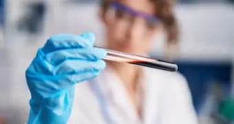 Найден способ определить риск нескольких заболеваний на годы вперед