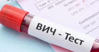 В Мангистау отмечен спад инфицирования ВИЧ