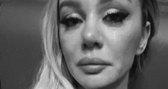 «Ни одного бокала не пропускает»: у Анны Седоковой могут быть проблемы с алкоголем