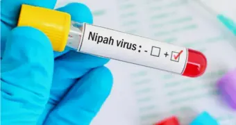 Названы страны, в которых циркулирует вирус Нипах