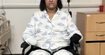 Женщине ампутировали конечности из-за слюны собаки