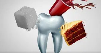 Названы неожиданные продукты, уничтожающие ваши зубы