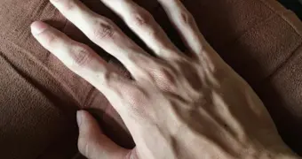 Фотография руки может помочь выявить опасное заболевание